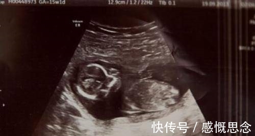 出血|怀孕6个月出血 女子药物堕胎 胎儿竟奇迹存活