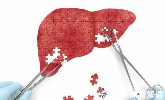 脚掌|脚上出现这三种信号,肝脏或许早已“烂如筛网”,请尽早检查