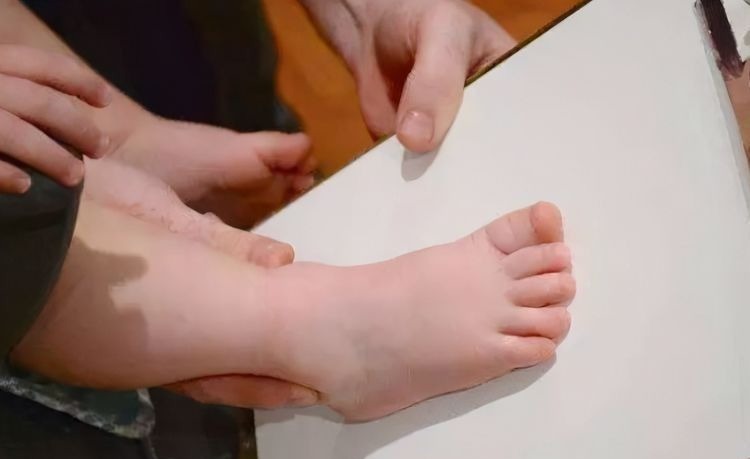 合脚|给娃买鞋子要买大一号?那些家长误以为的好处,其实是在坑娃