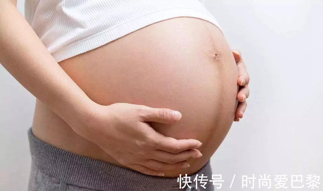 胎记|40%宝宝胎记不是来自遗传，更多是因为孕妈，孕期太放纵四个行为