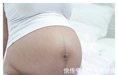 妊娠纹|怀孕后,肚子长毛还有黑色直线,怎么回事儿?
