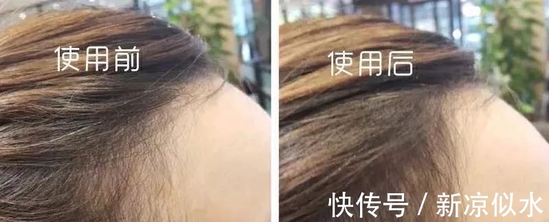 发际线|谁说发际线不够只能刘海来凑?你还可以这样做