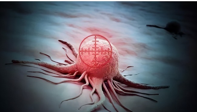 医生|癌症患者,最终因什么而死3个原因,医生很少和家属说