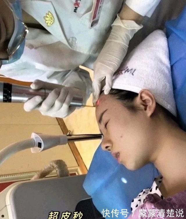 医美项目 哪些医美项目能让人变得干净!