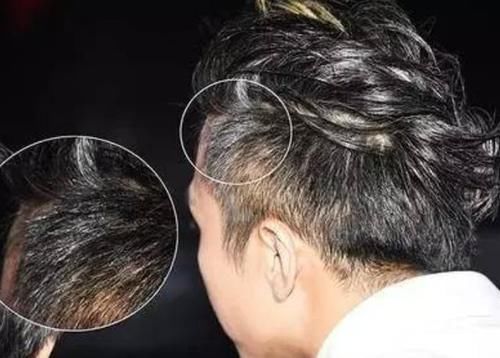 黑豆|长出白头发尽量不要染，不妨多吃这5样食物，抓紧收藏起来吧！