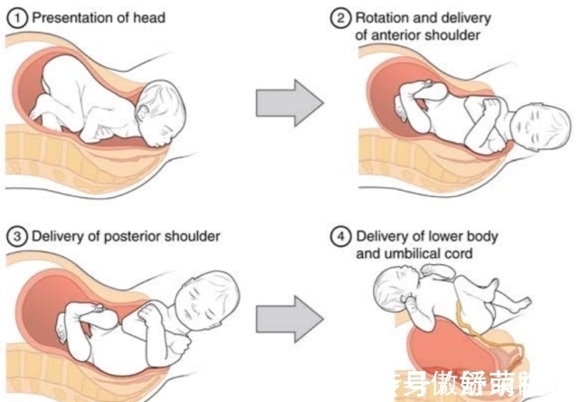 进化|为何动物的生产那么轻松，而人类分娩却疼得撕心裂肺？