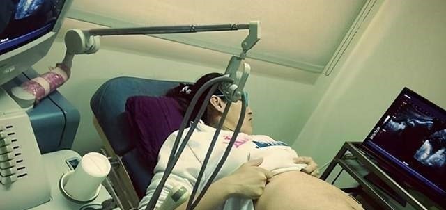 胎心|怀孕8个月,产检被告知多条腿,娃生下全家乐了,网友反应很直接