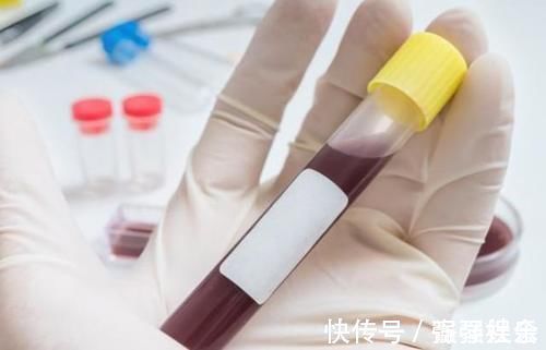 缺钙|晚上睡觉时若有3个表现,或是在警告你:血脂已高过“警戒线”