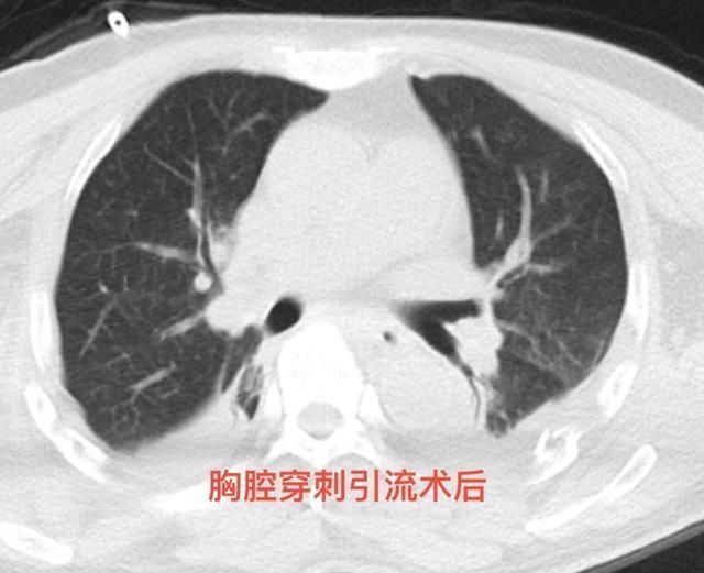 多学科协作接力完成六部位手术 淄博市中心医院助高处坠落患者转危为安