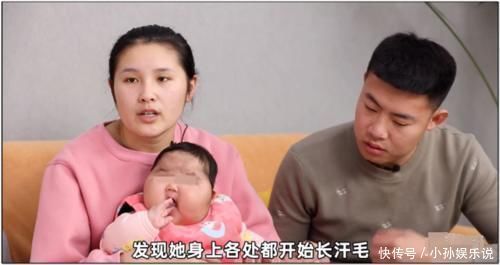 剂量|惊人反转?宝宝被大剂量涂抹面霜?大头娃娃父母被质疑了!