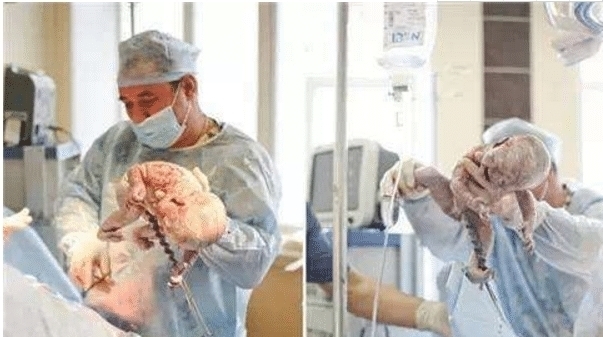 妈妈|产妇刚生完宝宝,忽然一句“想上厕所”,医生大喊:准备手术