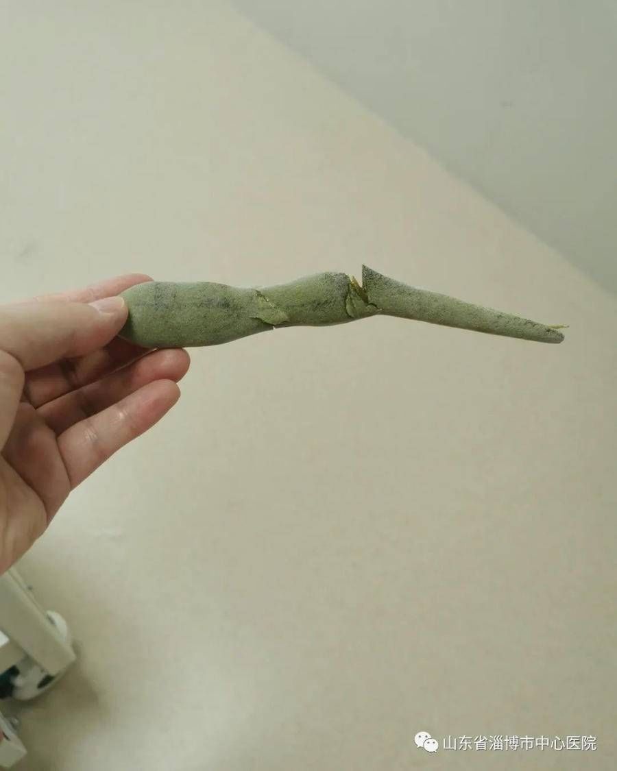 豆荚|路边常见“紫藤”含剧毒！儿童误食致中毒，医院紧急抢救