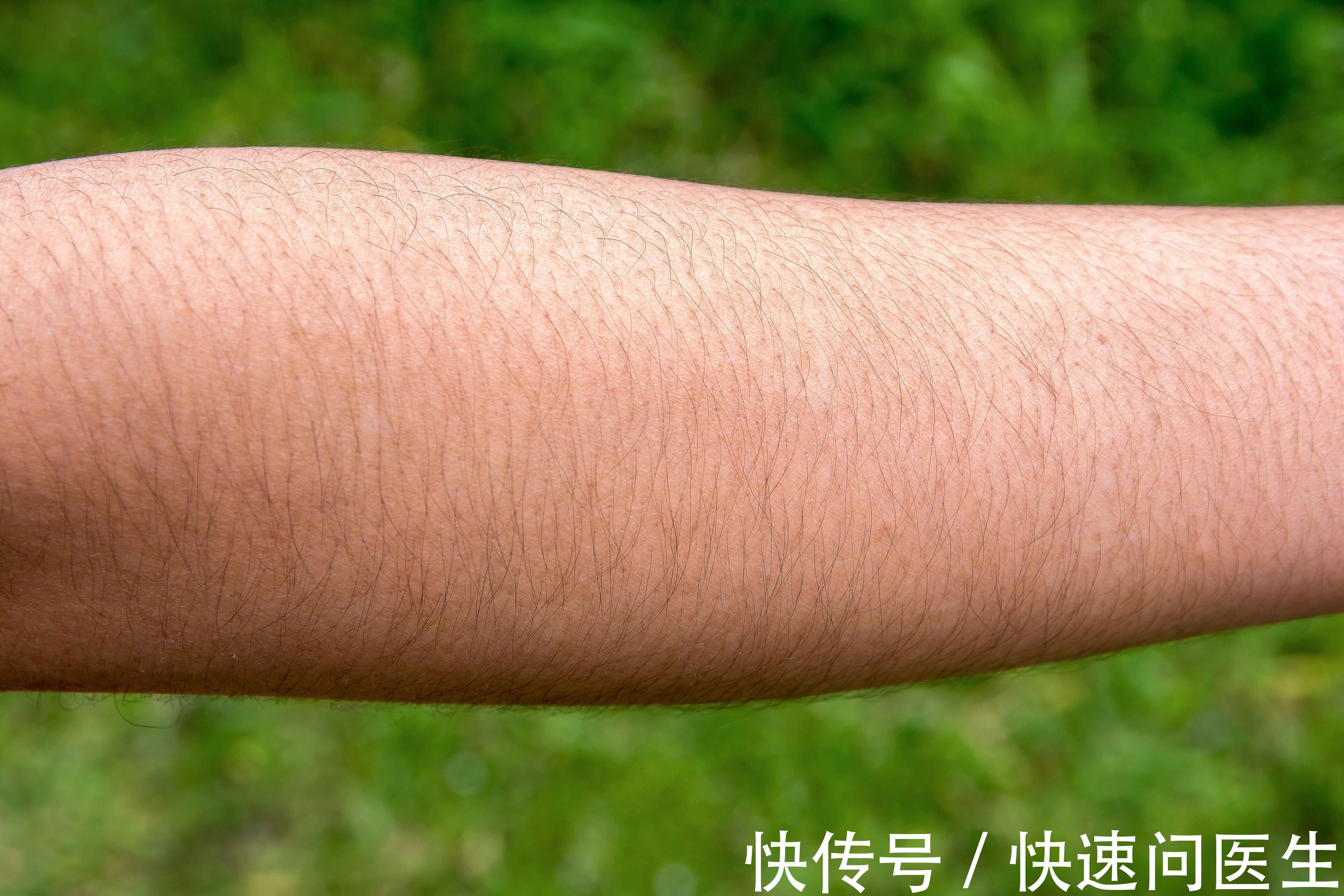 汗毛|女性汗毛浓密的原因有哪些?频繁使用脱毛产品,未必是好事