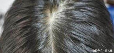 洗头|头发才1天不洗就能拧出油来,下次洗头扔点它,控油去屑!