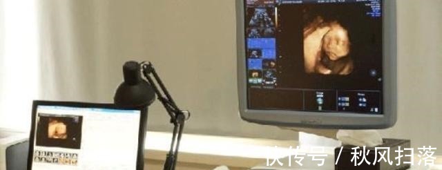 算数|“天才”胎儿走红,还在妈妈肚里就会“算数”,医生清华北大等你