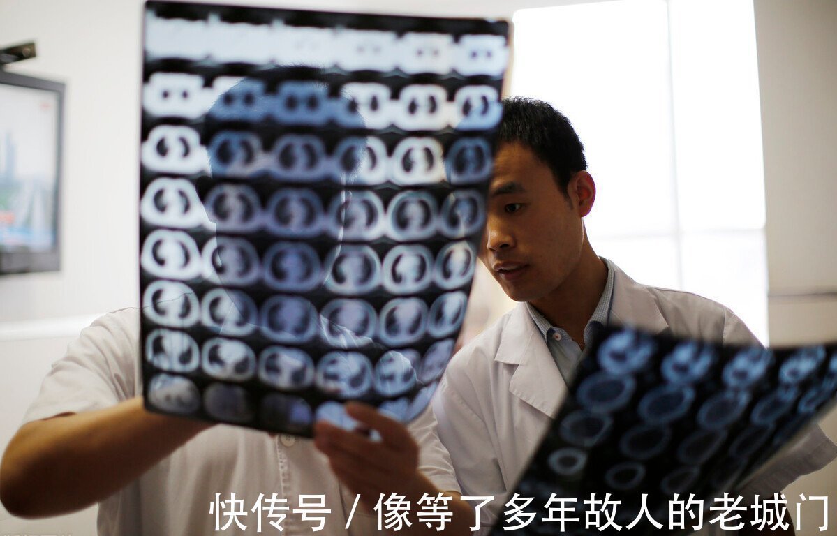 大脑|9岁孩子查出“健忘症”,医生叹息:2类食物哪能天天吃,平时少买