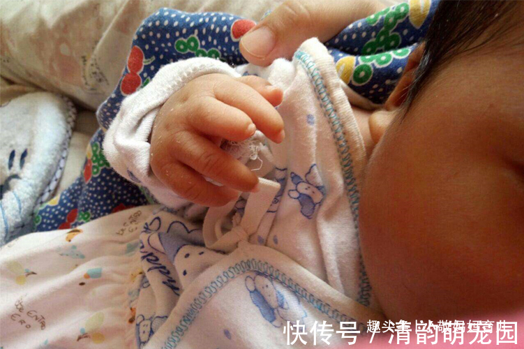 医生|宝宝出生长了“凤爪”,宝妈谎称孕期吃了鸡爪,却被医生当场揭穿