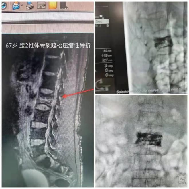 科室|【三水人医】专科建设显成效 四级手术来领航