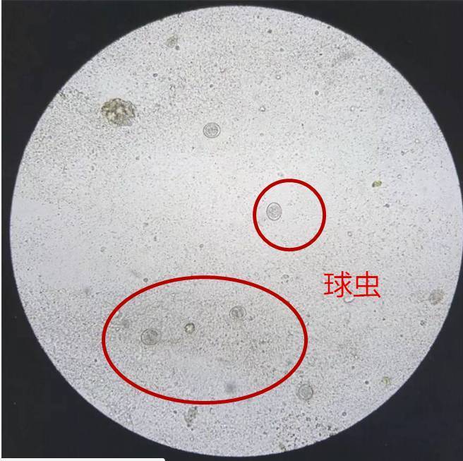 盐水|3种水果中含有寄生虫，孩子再喜欢也要尽量少吃，不如多吃这几种