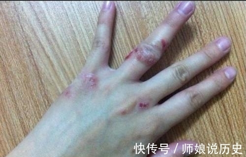 护肝|现代医学发现:食用这种中药,有护肝养胃等五大健康疗效!