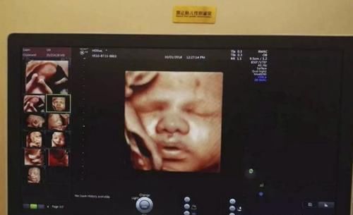 产房|“最美新生儿”的颜值引众多宝妈羡慕,助产士:新生儿中实属少见