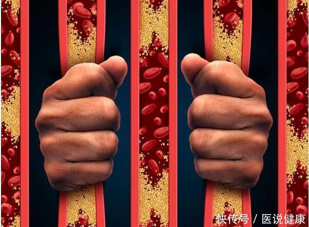 高血脂|不想被高血脂“盯上”,做好这4件事,稳定血脂不超标