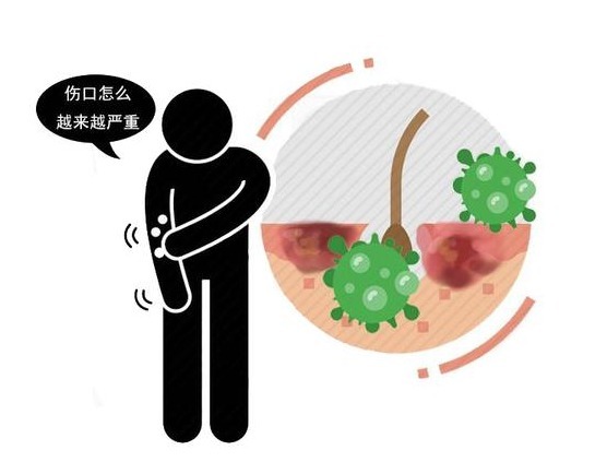 分子|哪种“痣”是危险分子?医生提醒:长在这3处的痣,要格外当心