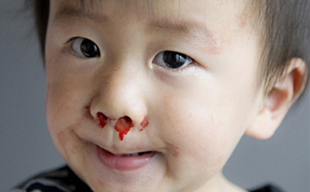 白血病|3岁小孩竟患上白血病,“凶手”在你家中,别不当回事,引以为戒