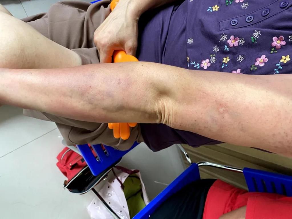  敬重|被忽视的大肠经——值得敬重的人体血液清道夫