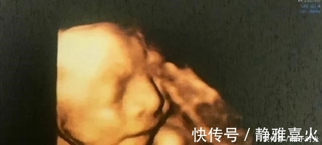 孕友|肚子里的胎儿有“七大怕事”,准妈妈不要再做了,以免伤身又伤娃