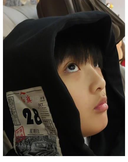 永久性|錄《爸爸去哪兒》造成眼角永久性傷害，13歲費(fèi)曼露無(wú)劉海正臉