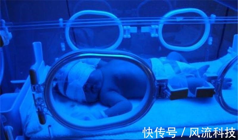 黄疸|黄疸新生儿刚出院又入院家长晒太阳退黄惹祸!医生治疗全身换血