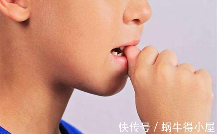 脊柱侧弯|孩子有“恋物癖”,每天摸着毛毯才能睡着?四大坏习惯要及时改正