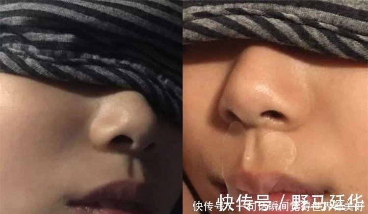 黄女士|宝宝爱生病,是抵抗力太差惹的祸?这个“锅”抵抗力不背!!