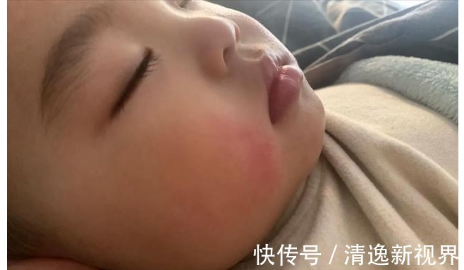 肖主任|退休院士声明爱积食的孩子,早晚2件事,坚持4天,胜吃消食片