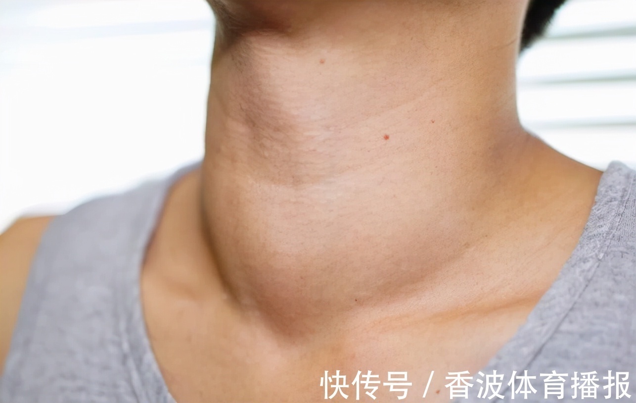 结节|甲状腺结节患者能吃馒头吗?提醒:不想结节转恶,3种素食要少碰