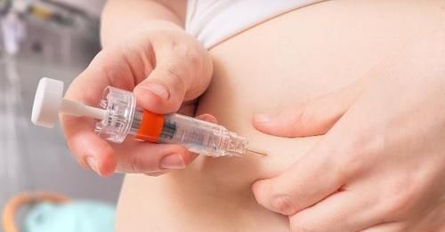  运动不仅可|运动被称降血糖的“利器”，糖友不妨尝试3个小运动，血糖或直降