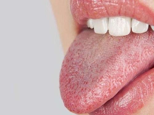 西医|舌头也是“警报器”,教你观察舌头的5种现象,平时要多留心