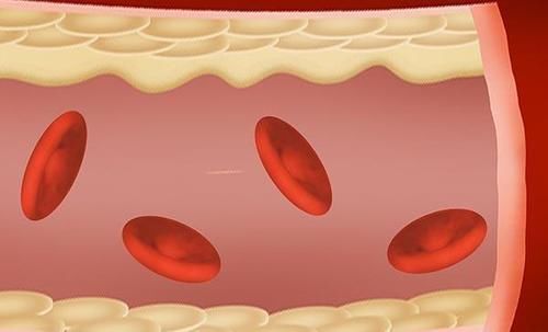 高血压|高血压吃三七粉,是降血压还是伤血管 听医生说完,就明白了