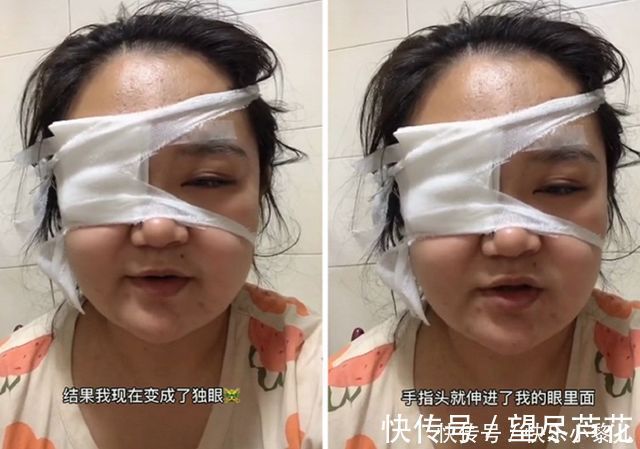 手部|小宝宝杀伤力有多强?宝妈:我为你剖腹7层,你却让我变“独眼”