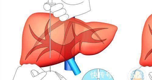三阴交|肝脏干净的女人,一般会有这3个“表现”,你若全有,真心不错