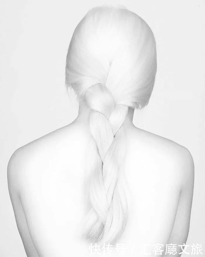 逆袭|因“全身雪白”被遗弃的中国女孩,逆袭成超模的故事让人泪目