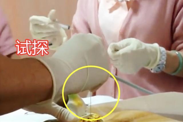 羊水穿刺|准妈妈做“羊水穿刺”现场,老公默默的喊加油,而妈妈已哭成泪人