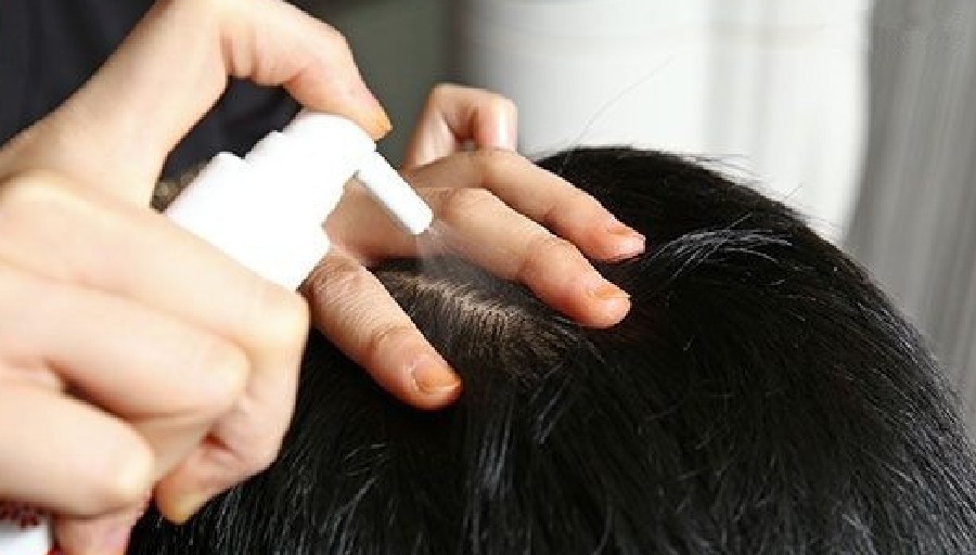 头皮 白发多也不要频繁染发,伤发又上头皮,这四个小妙招解决白发困扰