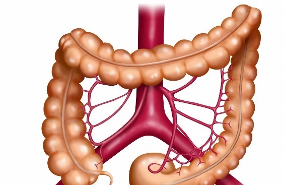 便血|73岁老奶奶肠癌晚期,只因上厕所总有1种感觉,太粗心害了自己