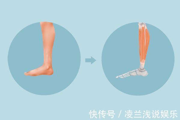 超标|尿酸升高，腿先知？腿部出现哪些异常，说明尿酸或已高到离谱了？