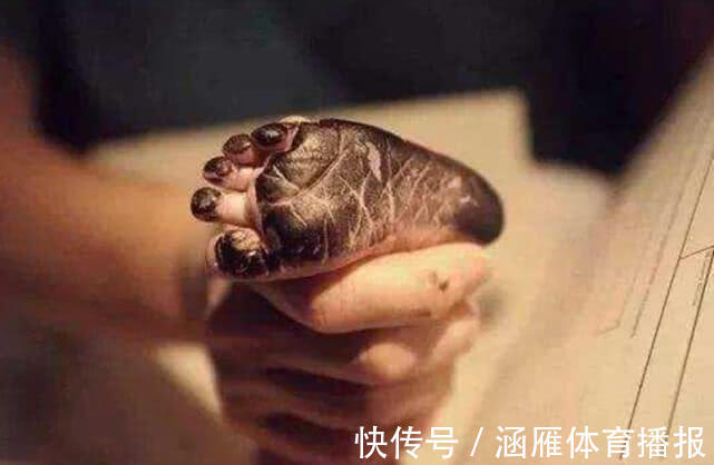 护士|孩子刚出生就“死亡”,妈妈接受不了,随后的动作挽救了孩子