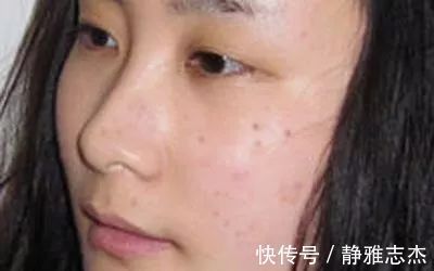 三七|70岁不长斑,她的诀窍竟如此简单,谁都可学会