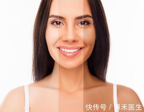 皮肤|被太阳晒黑了怎么变白