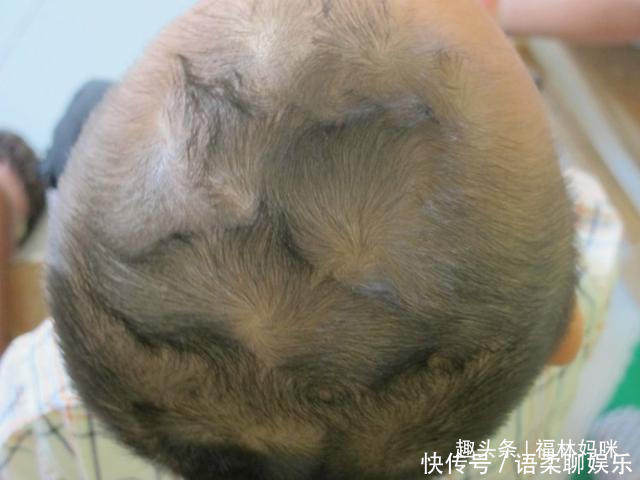 “双顶男孩找不到，双顶女孩没人要”，孩子头上的“旋”代表了啥